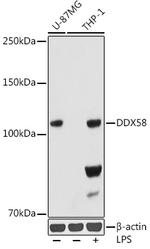 RIG-I Antibody in Western Blot (WB)