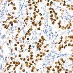 SALL4 Antibody in Immunohistochemistry (Paraffin) (IHC (P))