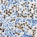 SALL4 Antibody in Immunohistochemistry (Paraffin) (IHC (P))