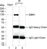 Drebrin Antibody in Immunoprecipitation (IP)