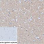 SNAP25 Antibody in Immunohistochemistry (Paraffin) (IHC (P))