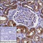 PKD2 Antibody in Immunohistochemistry (Paraffin) (IHC (P))