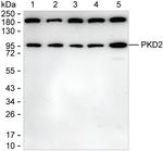 PKD2 Antibody in Western Blot (WB)