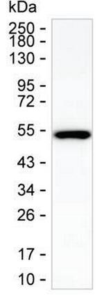 SHMT1 Antibody in Western Blot (WB)