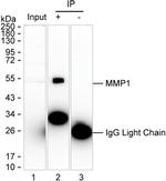 MMP1 Antibody in Immunoprecipitation (IP)