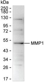 MMP1 Antibody in Western Blot (WB)