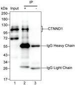 delta Catenin Antibody in Immunoprecipitation (IP)