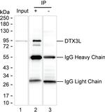 DTX3L Antibody in Immunoprecipitation (IP)