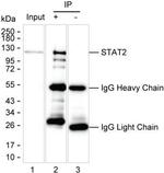 STAT2 Antibody in Immunoprecipitation (IP)