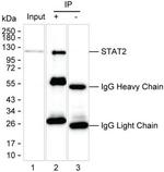 STAT2 Antibody in Immunoprecipitation (IP)