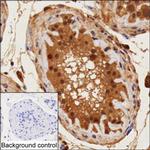 PSMD1 Antibody in Immunohistochemistry (Paraffin) (IHC (P))