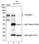 delta Catenin Antibody in Immunoprecipitation (IP)