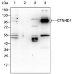 delta Catenin Antibody in Western Blot (WB)