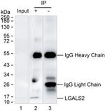 Galectin 2 Antibody in Immunoprecipitation (IP)