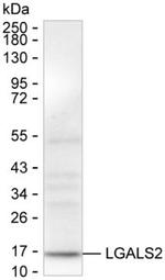 Galectin 2 Antibody in Western Blot (WB)