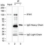 MDA5 Antibody in Immunoprecipitation (IP)