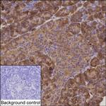 CARS Antibody in Immunohistochemistry (Paraffin) (IHC (P))