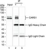 CARS Antibody in Immunoprecipitation (IP)