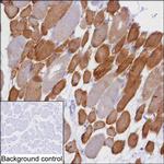 PFKM Antibody in Immunohistochemistry (Paraffin) (IHC (P))