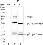 PFKM Antibody in Immunoprecipitation (IP)