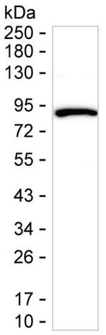 PFKM Antibody in Western Blot (WB)