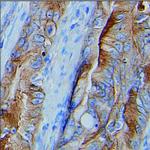 delta Catenin Antibody in Immunohistochemistry (Paraffin) (IHC (P))