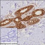 PDCD4 Antibody in Immunohistochemistry (Paraffin) (IHC (P))