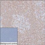 IL-16 Antibody in Immunohistochemistry (Paraffin) (IHC (P))