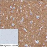 SNAP25 Antibody in Immunohistochemistry (Paraffin) (IHC (P))