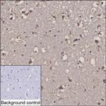 RCAS1 Antibody in Immunohistochemistry (Paraffin) (IHC (P))