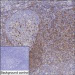 BTLA Antibody in Immunohistochemistry (Paraffin) (IHC (P))