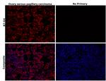 B7-H4 Antibody in Immunohistochemistry (Paraffin) (IHC (P))