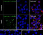 Phospho-Syk (Tyr525, Tyr526) Antibody in Immunocytochemistry (ICC/IF)