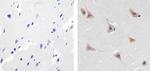 ALK Antibody in Immunohistochemistry (Paraffin) (IHC (P))