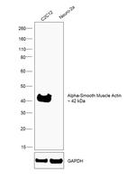 Alpha-Smooth Muscle Actin Antibody