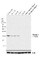 Calponin 1 Antibody in Western Blot (WB)