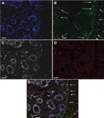 CD44 Antibody in Immunohistochemistry (IHC)