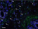 CD44 Antibody in Immunohistochemistry (IHC)