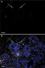 CD44 Antibody in Immunohistochemistry (IHC)