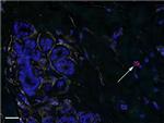 CD44 Antibody in Immunohistochemistry (IHC)