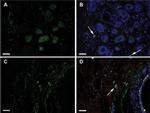 CD44 Antibody in Immunohistochemistry (IHC)