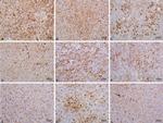 Prolactin Receptor Antibody in Immunohistochemistry (IHC)