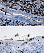 Calprotectin Antibody in Immunohistochemistry (Paraffin) (IHC (P))