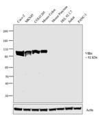 Villin Antibody in Western Blot (WB)