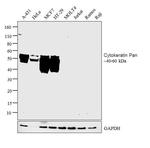 Cytokeratin Pan Antibody