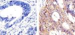 EpCAM Antibody in Immunohistochemistry (Paraffin) (IHC (P))