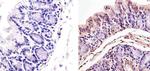 p53 Antibody in Immunohistochemistry (Paraffin) (IHC (P))