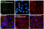 E-cadherin Antibody