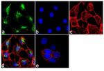 Cytokeratin 5 Antibody in Immunocytochemistry (ICC/IF)