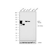 Cytokeratin 5 Antibody in Western Blot (WB)